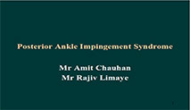 Posterior Ankle Impingement Syndrome